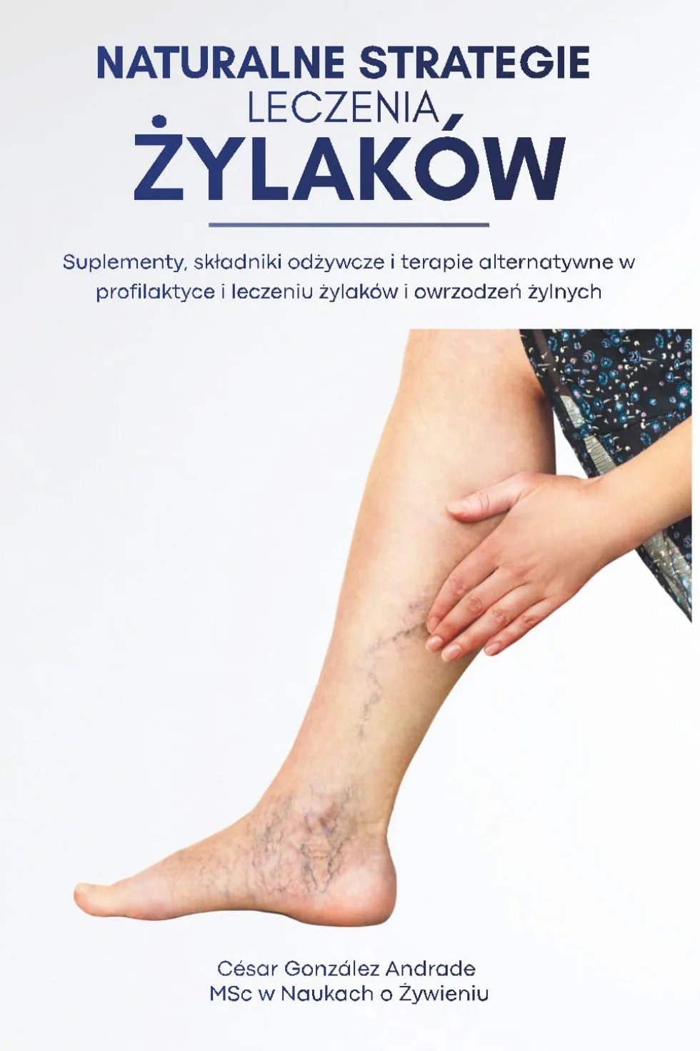 Naturalne strategie leczenia żylaków: Suplementy, składniki odżywcze i terapie alternatywne