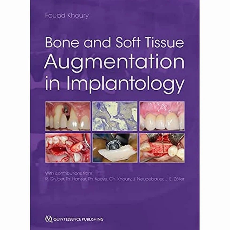 Bone and Soft Tissue Augmentation in Implantology