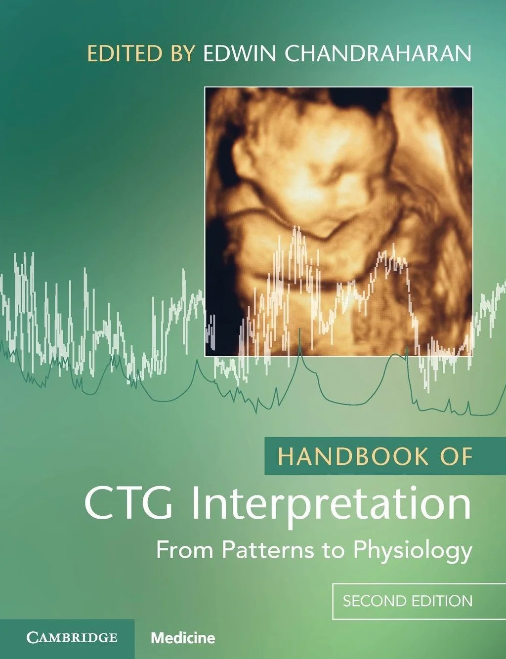 Handbook of CTG Interpretation: From Patterns to Physiology