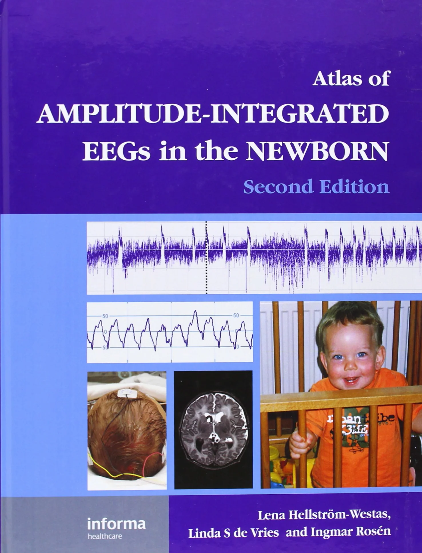 Atlas of Amplitude-Integrated EEGs in the Newborn