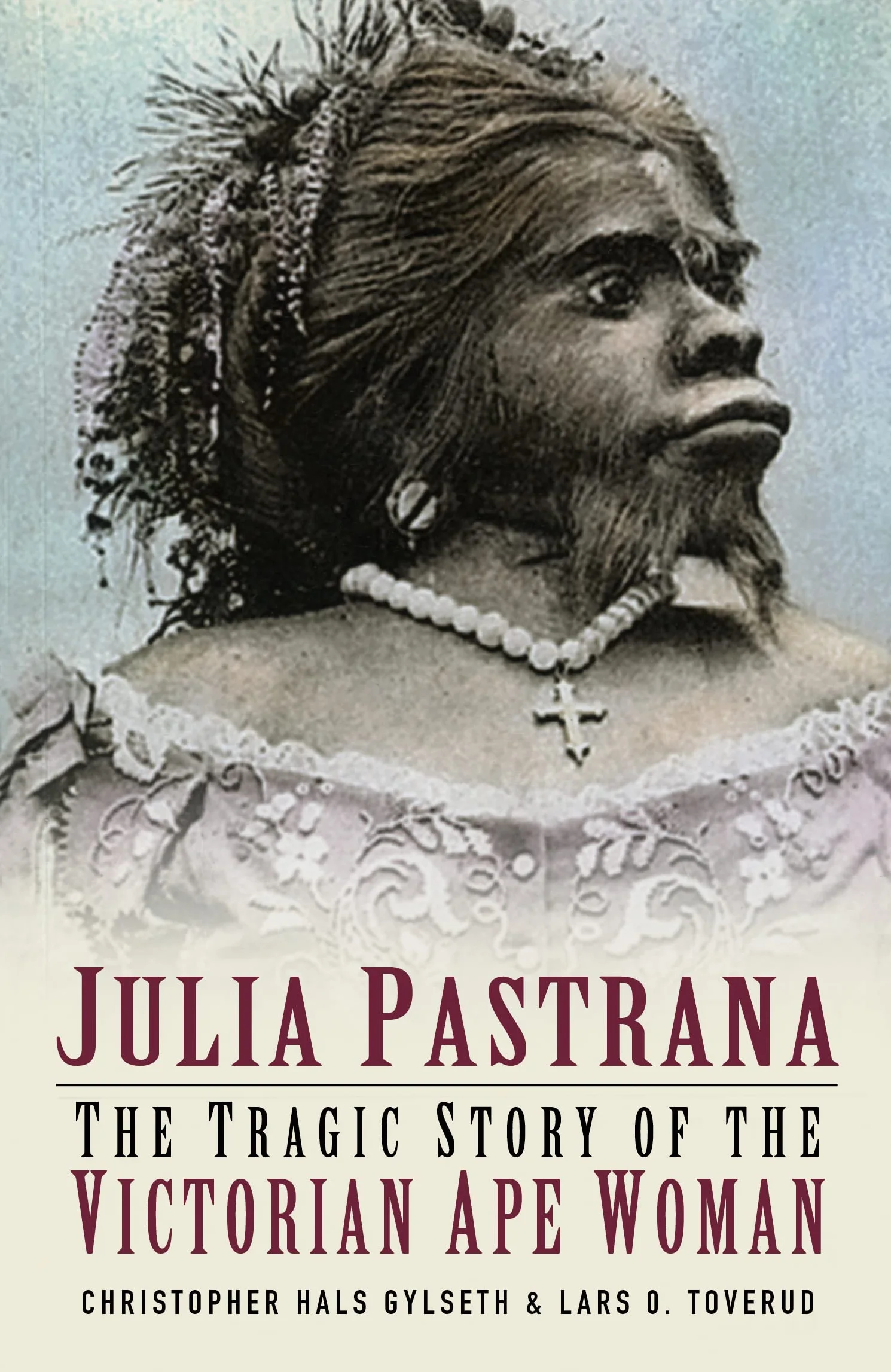 Julia Pastrana: The Tragic Story of the Victorian Ape Woman