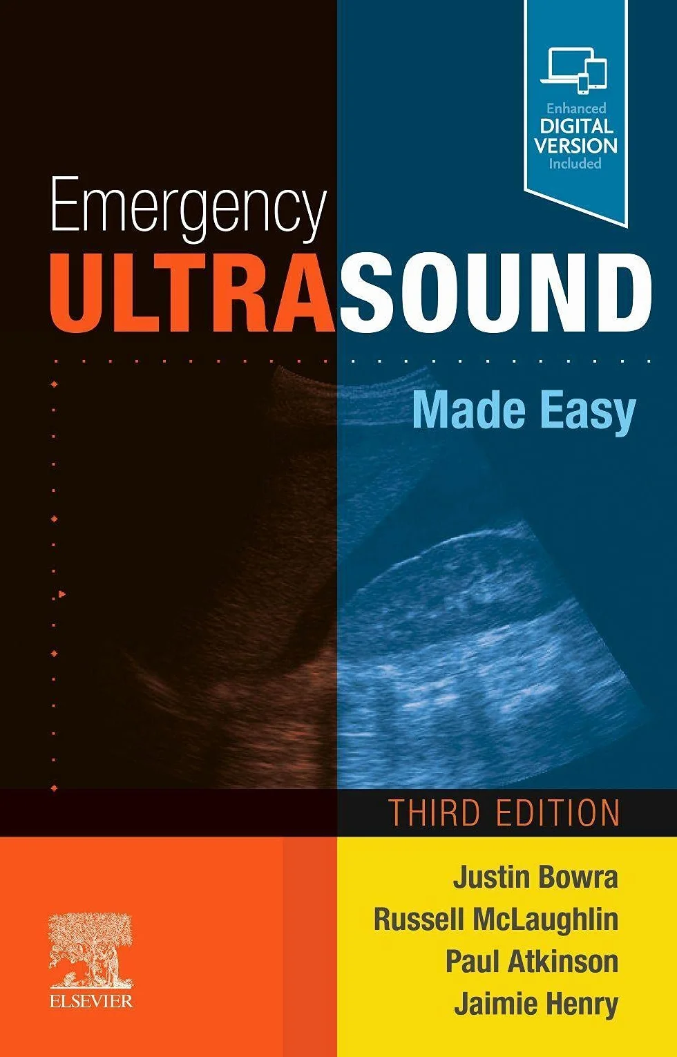 Emergency Ultrasound Made Easy